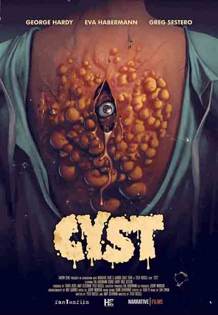 Cyst (2022) [DVD]